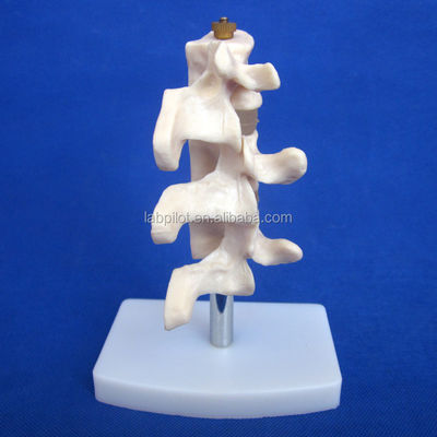 Modelos educativos avanzados de PVC Cutaway Osteoporosis de la columna vertebral Lesiones de la vértebra lumbar