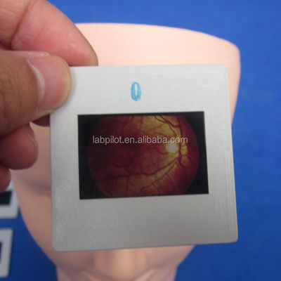 Maniquí para el examen avanzado del ojo humano simulador de entrenamiento de retinopatía modelo de fondo