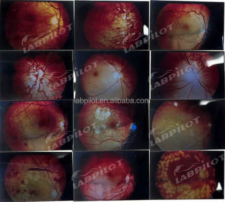 Maniquí para el examen avanzado del ojo humano simulador de entrenamiento de retinopatía modelo de fondo