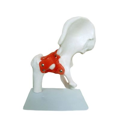 Estructuras anatómicas detalladas Enseñanza médica Modelo de articulación de cadera con ligamento artificial hueso humano