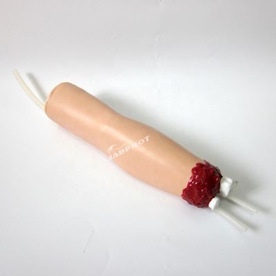Modelo de cuidados de enfermería de trauma Amputación del brazo y hemostasis para el tratamiento de heridas de extremidades superiores