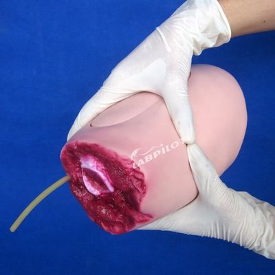 Modelo avanzado de PVC La solución ideal para la enfermería de amputación de extremidades inferiores