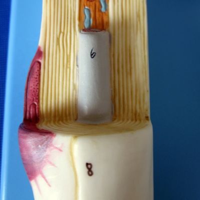 Modelo anatómico avanzado de PVC del cuerpo neuronal ampliado y la estructura de las fibras nerviosas