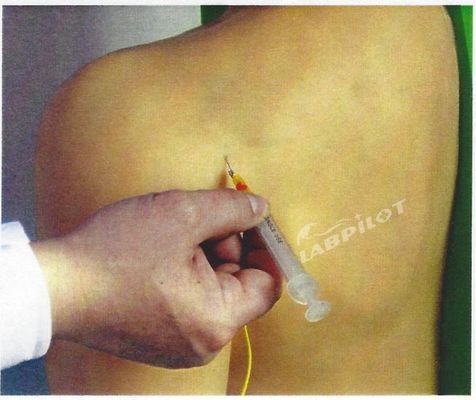 Formación médica avanzada en PVC Modelo de enseñanza de simulador de inyección intracavitaria de la articulación del hombro