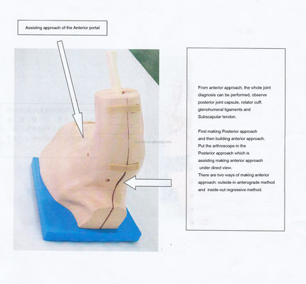 Modelo de entrenamiento de anatomía de la articulación del hombro con simulador desmontable de artroscopia del hombro