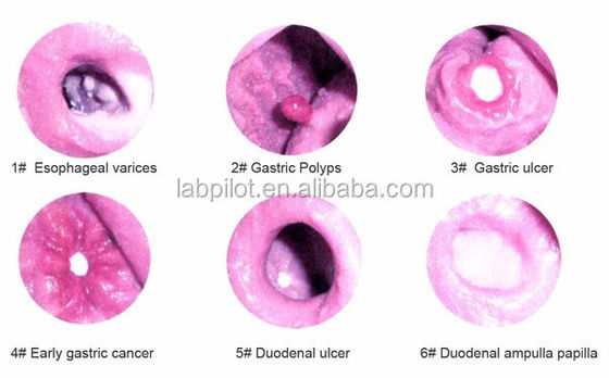 Examen gastroscópico avanzado y modelo de formación ERCP para lesiones gastrointestinales
