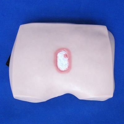 Modelos de formación en enfermería clínica Etapas del decúbito úlcera Atención de enfermería para hospitales