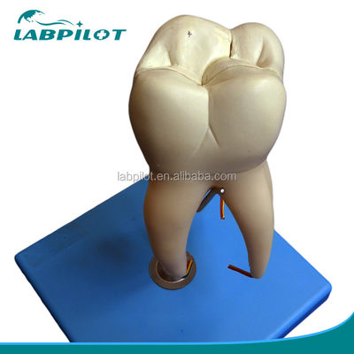 Demonstración de cuidado dental Modelo de dientes anatómicos desmontables para dientes molares de tres raíces