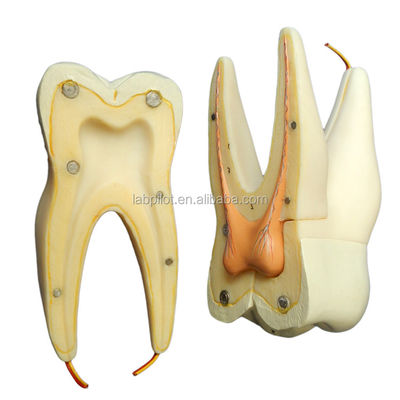Demonstración de cuidado dental Modelo de dientes anatómicos desmontables para dientes molares de tres raíces
