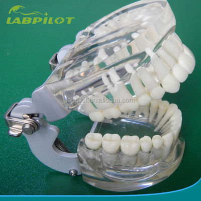 Modelos de formación en odontología Transparente adulto estándar Columna dental modelo tamaño estándar