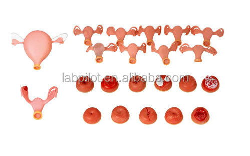 Maniquí para ginecólogo multifuncional Formación de enfermería Modelo de examen vaginal