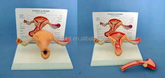 Modelo avanzado de PVC del útero y del ovario humanos para la educación del sistema reproductivo femenino