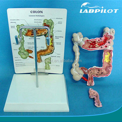 Modelos oftalmológicos Modelos anatómicos Modelo intestinal humano para enfermedades del colon y el recto