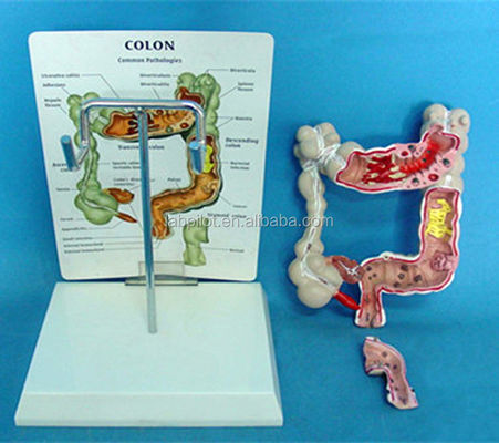 Modelos oftalmológicos Modelos anatómicos Modelo intestinal humano para enfermedades del colon y el recto