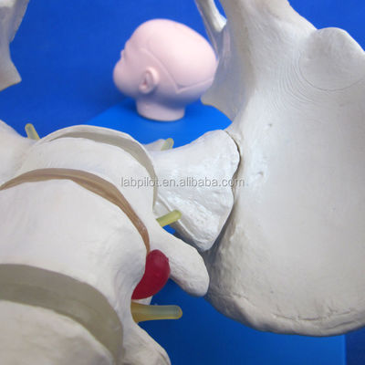 Pelvis vivo y cabezas fetales Modelo avanzado de PVC para la demostración de habilidades de parto