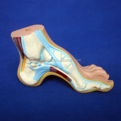 Categorías Estructuras anatómicas detalladas Biológicas 3D Modelos normales de pies planos y arqueados