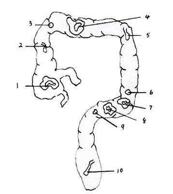 Modelo de anatomía del recto y el colon PVC avanzado Simulador de endoscopia intestinal de tamaño de vida humana
