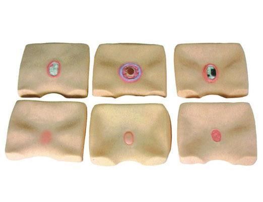 Simulador de úlceras de decubitus de piel de glúteos para hospitales Mejorar la capacitación en enfermería de úlceras de cama