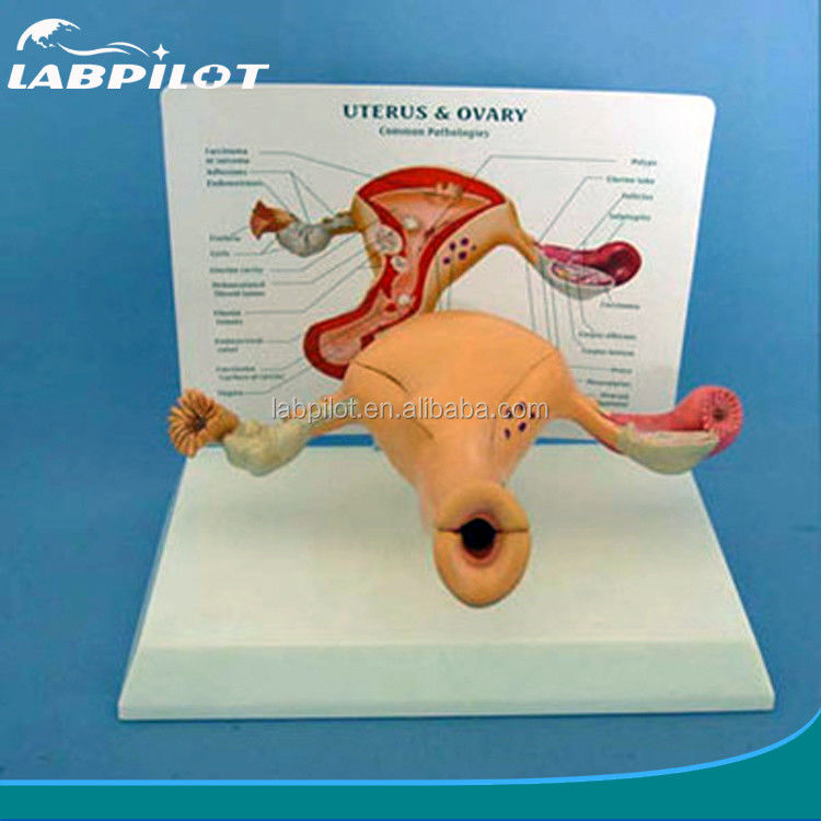 Modelo avanzado de PVC del útero y del ovario humanos para la educación del sistema reproductivo femenino