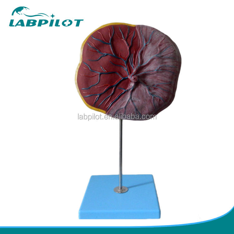 Ciencias médicas Modelo 3D de placenta humana y cordón umbilical con anatomía detallada