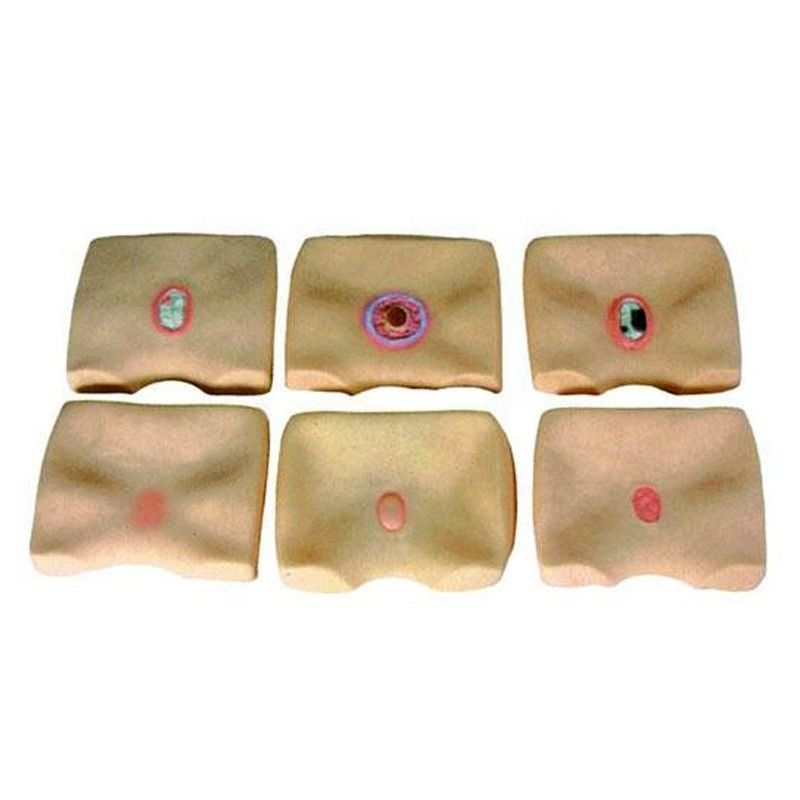 Simulador de úlceras de decubitus de piel de glúteos para hospitales Mejorar la capacitación en enfermería de úlceras de cama